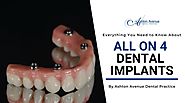 What are All on 4 Dental Implants?