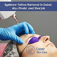 Eyebrow Tattoo Removal in Dubai, Abu Dhabi and Sharjah