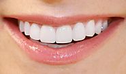 Benefits of Zoom Teeth Whitening Treatment Dubai - dubailasertreatmentss.over-blog.com