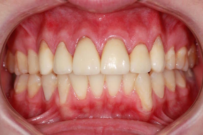 types-of-teeth-and-their-functions-a-listly-list