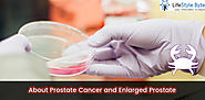 About Prostate Cancer and Enlarged Prostate - Self Diagnostics