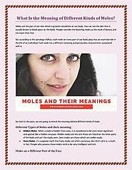 What is the Meaning of Different Kinds of Moles |authorSTREAM
