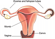 Removal of the uterus(Laparoscopic Hysterectomy)