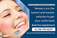 How to choose a cosmetic dentist for veneers