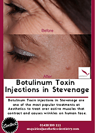 Botulinum toxin injections Stevenage