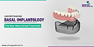 Basal Implantology – Complete Painless Treatment