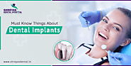 Important Information You Need to Know about Dental Implants