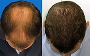 Professional Hair Transplant and Plastic Surgery