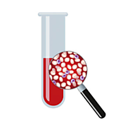 How Liquid biopsy is the ultimate substitute common to all cancers