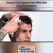 Hair Transplant Network — Instant Full Head of Hair With Hair Loss...