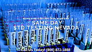 STD Testing Las Vegas NV