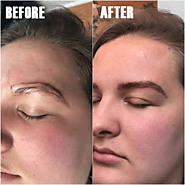 Microblading Services in Louisville | BodyRx