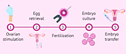 Gestational & Traditional Surrogacy Process | Rite Options