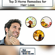 Top 3 Home Remedies for Hair Loss – Hair Transplant Network