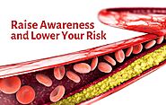 PAD & Vascular Disease Awareness Month | USA Vascular Centers