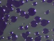 Purple-pigmented Chromobacterium violaceum