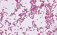 Gram-negative, rod-shaped Chromobacterium violaceum