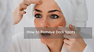 Dark Spots: Causes & How to Remove Dark Spots
