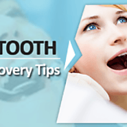 Root Canal Cost In Pune | Best Dentist in FC Road and Mukund Nagar