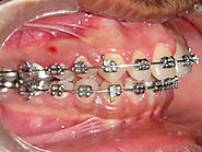 Website at https://www.dentalsphere.in/treatment/orthodontist-pune