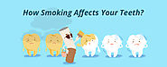 Website at https://www.dentalsphere.in/blog/how-smoking-affects-teeth