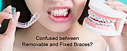 Confused between Removable and Fixed Braces? | Orthodontist in Pune