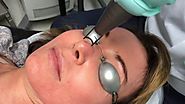 Pore tightening with Spectra Dr. Kara Plastic Surgery Toronto