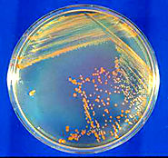 This is what Conan the bacterium looks like on an agar plate.