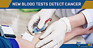 New Blood Tests Detect Cancer – Is It True?