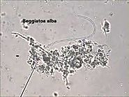 Beggiatoa alba: colorless and filamentous proteobacteria