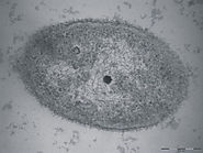 This image displays a negative stain electro micrograph of H.titanicae