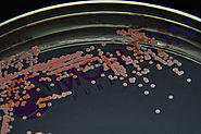 Deinococcus radiodurans grown on trypticase soy agar