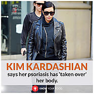 Kim Kardashian Says Her Psoriasis Has Taken Over Her Body