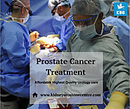 Prostate Cancer Treatment – KUC