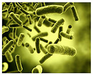 E.coli expression