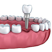 Get Tips From US Regarding Dental Care