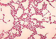 Gram positive Bacillus coagulans