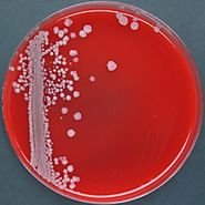 B. coagulans on agar