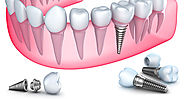 Dental Treatment services - What to Expect From Your Dentist