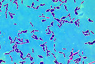 The Lactobacillus Reuteri showing its purple pigment