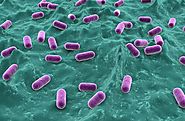 Gram-positive, Rod-shaped Lactobacillus Reuteri