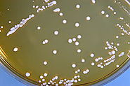 Lactobacillus brevis colony formation in an agar plant