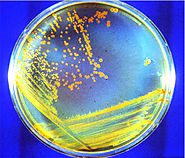 Four-way streak of Deinococcus radiodurans