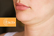 Effective Ways to Get Rid of Double Chin - Clarity MedSpa