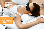 Getting a Laser Hair Removal in Toronto? Here's What You Need to Know - Clarity MedSpa