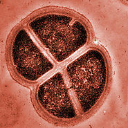 Red-pigmented, non-motile, nonsporulating Deinococcus radiodurans