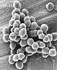 this an Electro-micrograph of Streptococcus Pyogenes OK-432, pretty cool right??