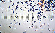 Lactobacillus acidophilus - microbewiki