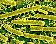 Lactobacillus Acidophilus under an electron microscope (the source of cheese)