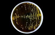 Lactobacillus casei survive with or without oxygen.